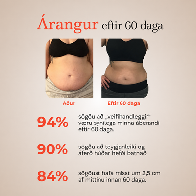 DEFINORA™ Waist | Dual-Wellenlängen Rotlichtgürtel mit 3-Lagen-Lift-Technologie™