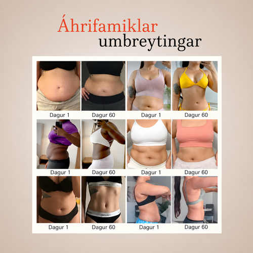 DEFINORA™ Waist | Dual-Wellenlängen Rotlichtgürtel mit 3-Lagen-Lift-Technologie™