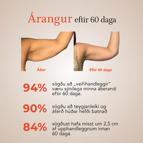DEFINORA™ Arm | Dual-Wellenlängen Rotlicht-Armwrap mit 3-Lagen-Lift-Technologie™