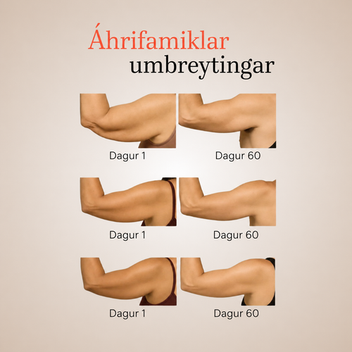 DEFINORA™ Arm | Dual-Wellenlängen Rotlicht-Armwrap mit 3-Lagen-Lift-Technologie™